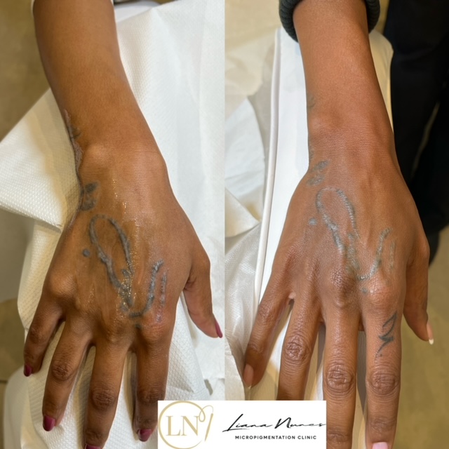 pigment-off